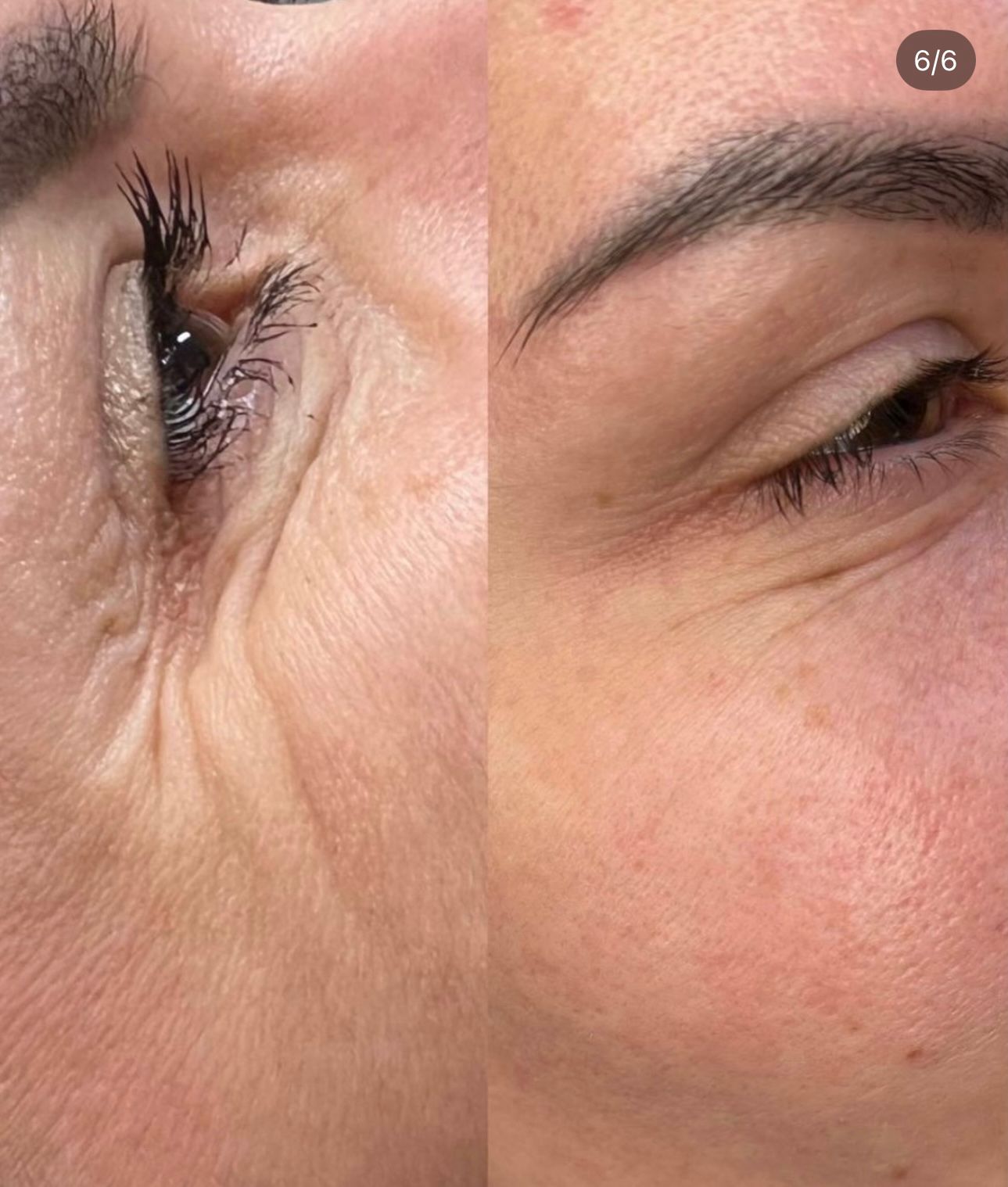 Hoitotulos 20